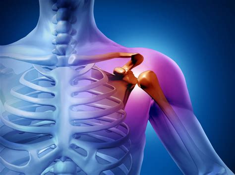 Эффективное лечение сильной боли в плечевом суставе